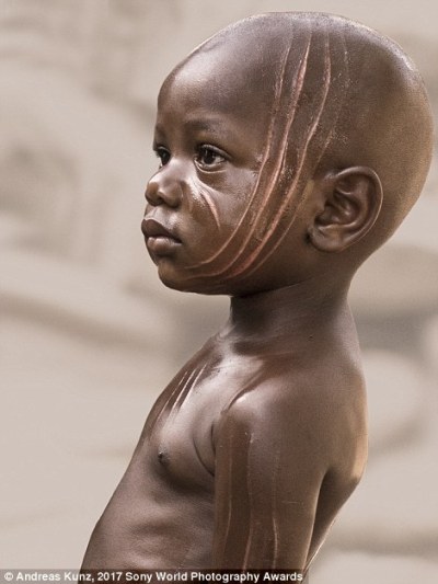 Một đứa trẻ nhỏ ở Togo, Tây Phi, với các vết thương tươi sẽ biến thành vết sẹo, dấu hiệu điển hình của bộ lạc Soma.