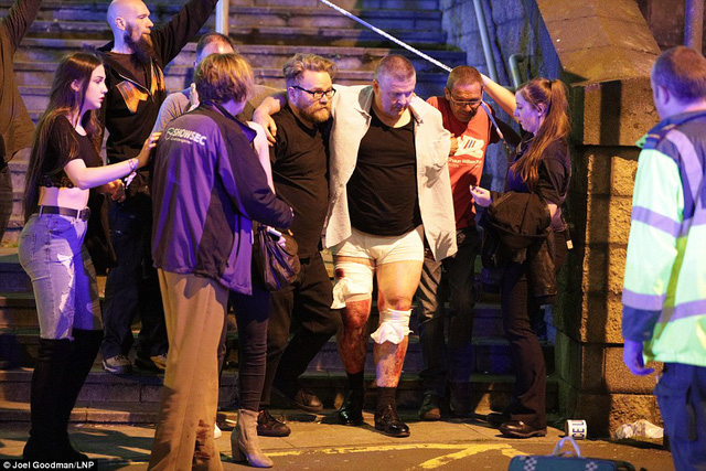 Một người đàn ông được nhiều người hỗ trợ đưa ra khỏi nhà thi đấu do bị thương ở chân (Ảnh: Telegraph)