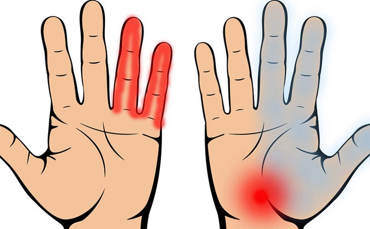 Các ngón tay đau hoặc sưng bất thường có thể là do ung thư phổi. Ngón tay bị sưng, nóng và đỏ nếu không phải là kết quả của thương tích bên ngoài, có thể là triệu chứng của một số bệnh, bao gồm ung thư phổi. Ngón tay bị sưng khiến bạn khó có thể cầm hoặc giữ đồ vật trong khi làm việc nhà bình thường, những triệu chứng như vậy không nên bỏ qua.