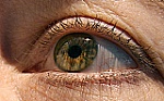 Đột phá: Ghép tế bào gốc vào mắt chữa mù