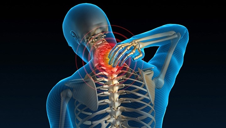 Viêm khớp: Viêm khớp có thể là một trong nhiều lý do gây đau cổ vì nó làm hỏng các đĩa đệm cổ, ảnh hưởng tới các dây thần kinh. Điều này thường xảy ra ở một bên cổ và cánh tay. Tê hoặc yếu ở cánh tay và bàn tay có thể là triệu chứng đầu tiên của viêm khớp.