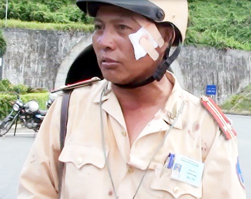 Lt. Col. Bui Hoa from Da Nang suffered several scratches after a truck driver ran him off the road on September 19, 2014 . Photos: Nguyen Tu