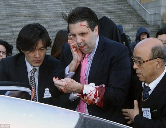 Đại sứ Mỹ tại Hàn Quốc Lippert được đưa tới bệnh viện. Ảnh: AP