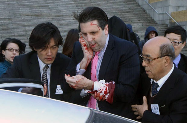 Đại sứ Mark Lippert bị thương ở mặt và tay trái.  		              Ảnh: AFP