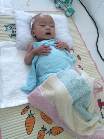 Bé Phạm Thanh Đức đang được điều trị tại Bệnh viện Phụ sản - Nhi Đà Nẵng.