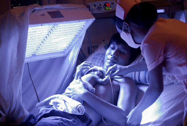 Chăm sóc em bé sinh non theo phương pháp kangaroo và chiếu đèn.