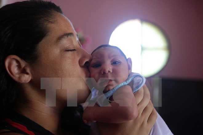 Một trẻ sơ sinh bị mắc căn bệnh đầu nhỏ do mẹ bị nhiễm virus Zika khi mang thai tại Rio de Janeiro ngày 4/2. (Nguồn: THX/TTXVN)