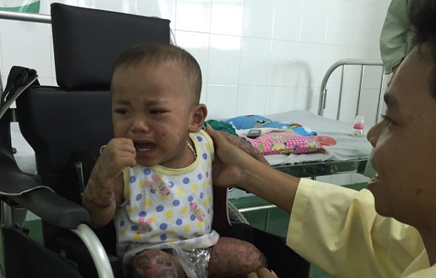  Poloong Quoc Quan in his newly-donated wheelchair