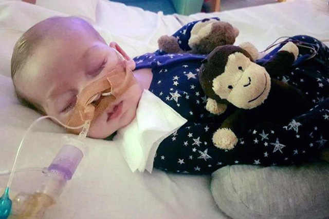 Bé Charlie Gard. (Ảnh: The Sun)