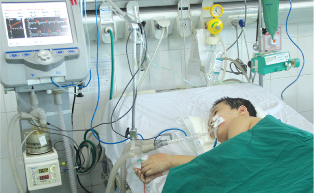 Cháu Hồ Hoàng Bảo Tân bị chứng teo cơ tủy sống, nằm liệt một chỗ và thở máy.