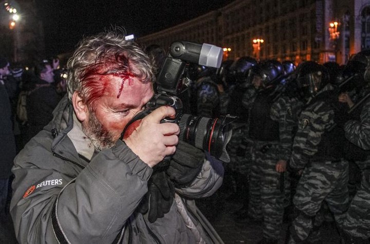 Nhà báo Garanich bị thương chảy máu ở đầu nhưng vẫn cố chụp ảnh về cuộc biểu tình ở Kiev, Ukraine vào tháng 11/2013.