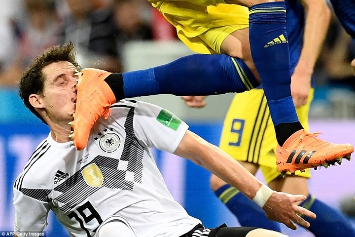 Tiền vệ người Đức, Sebastian Rudy hứng trọn gầm giày vào mặt sau tình huống va chạm với cầu thủ Ola Toivonen của Thụy Điển.