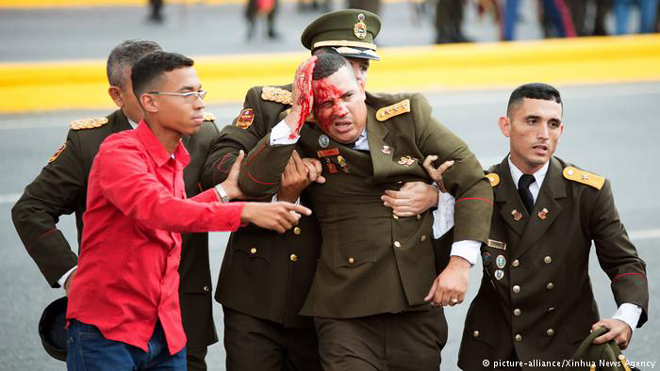 Nhiều thành viên lực lượng an ninh bảo vệ Tổng thống Nicolas Maduro bị thương trong vụ tấn công hôm 4-8. (Ảnh: Xinhua News Agency)