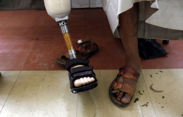 Một nạn nhân bị mất đi một chân trong cuộc xung đột ở Yemen đang ngồi chờ tại trung tâm phục hồi chức năng ở Sana's ngày 6/11/2018. Có khoảng gần 2 triệu người Yemen đang sống với những thương tật, trong đó gần 7.000 người bị cụt tay hoặc chân cũng như chịu đựng những vết thương nghiêm trọng kể từ khi giao tranh xảy ra tại quốc gia này năm 2015. 