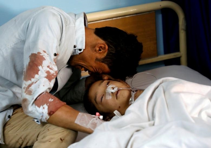 Nỗi đau khổ của một nam giới bên một bé gái bị thương đang nằm trong bệnh viện sau một vụ tấn công khủng bố ở Kabul, Afghanistan, tháng 4/2018.