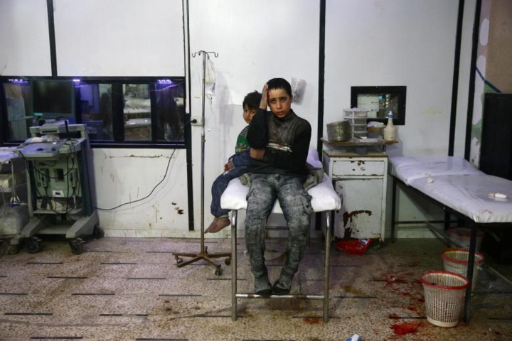 Trẻ em bị thương được sơ cứu tại một bệnh viện ở thị trấn Douma, Đông Ghouta, Syria.