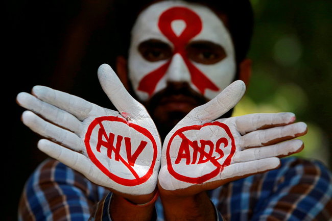 Kể từ khi đại dịch AIDS bắt đầu trong thập niên 80 của thế kỷ trước đã có hơn 77 triệu người mắc HIV. Ảnh: AP