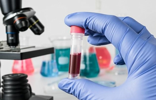 Xét nghiệm máu đơn giản phát hiện 7 loại ung thư