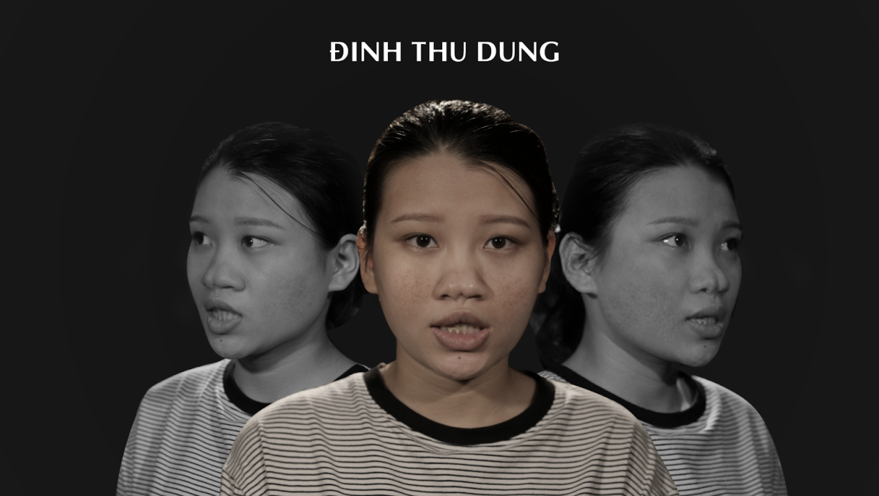 Hình ảnh Đinh Thu Dung với chiếc mũi không sống bị bạn bè gọi là “mũi quỷ”, “mũi lợn”...