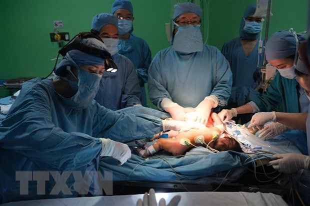 Bệnh viện Nhi đồng 1 phẫu thuật tách rời 2 bé gái song sinh dính nhau
