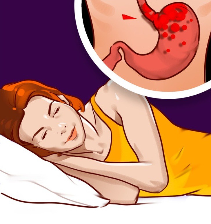Nằm nghiêng phải là tư thế ngủ có thể gây hại sức khỏe?