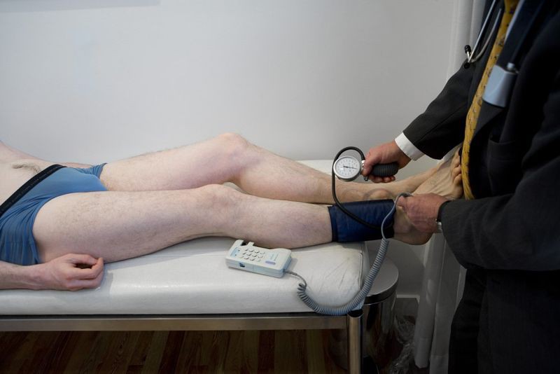 Bệnh tắc động mạch ngoại biên (PVD): Đây cũng là một nguyên nhân phổ biến gây lạnh bàn chân. Bệnh này là do tắc động mạch ở các chi, làm ngăn dòng lưu thông máu đến bàn chân, khiến bàn chân bị lạnh.