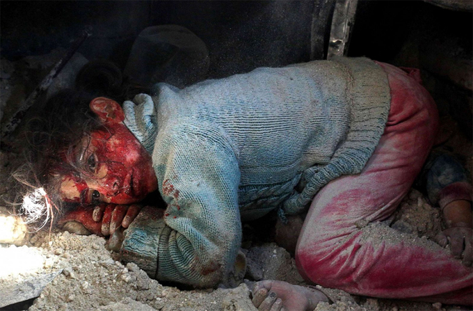 Một bé gái ở Khan Sheikhun, Syria, nằm dưới ngôi nhà sập đợi lực lượng cứu hộ đến, bên cạnh thi thể của chị gái, hôm 26/2. Ảnh: Anas Al-Dyab/AFP