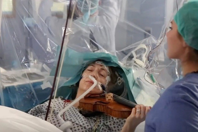Kinh ngạc nữ giáo sư chơi violin khi được mổ u não