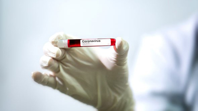 Tổng số ca nhiễm virus corona chủng mới SARS-CoV-2 (gây dịch bệnh Covid-19) trên toàn thế giới là 720.217 trường hợp. Ảnh: Scientific American