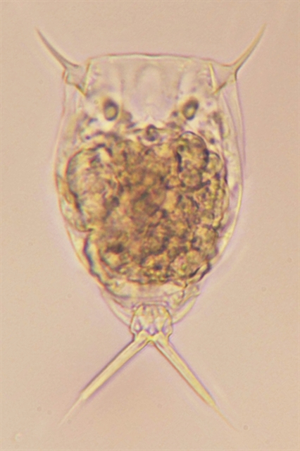 A microscope photo of a new rotifer species -- Lecane Langsenensis -- found by biologists from Da Nang. It's one of five rotifer species that were discovered