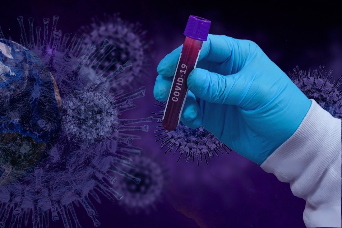 Giới chức Mỹ đã nghi ngờ virus SARS-CoV-2 xuất phát từ một phòng thí nghiệm ở Vũ Hán, Trung Quốc. 