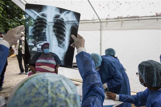 Bác sĩ kiểm tra phim chụp phổi của một bệnh nhân COVID-19 tại Santao Domingo, CH Dominica, ngày 17/6/2020. Ảnh: AFP/TTXVN