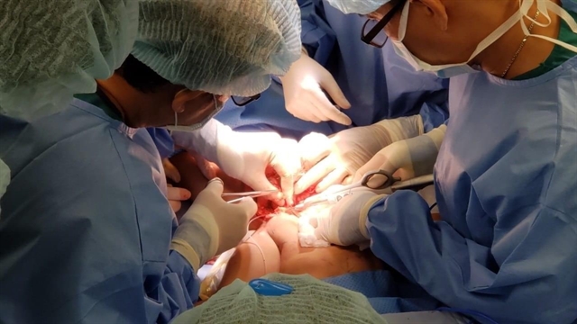 Doctors have successfully separated conjoined twins at the City Children’s Hospital in HCM City. — Photo courtesy of the City Children’s Hospital