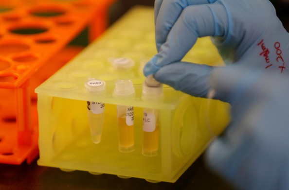 Phòng thí nghiệm của công ty dược phẩm sinh học Sorrento Therapeutics đang nghiên cứu kháng thể STI-1499 để tạo ra thuốc ngừa COVID-19. Ảnh: Reuters 