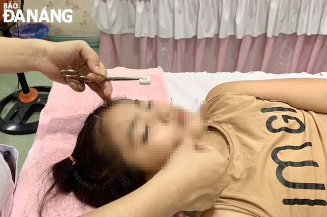 A child patient with distorted mouth due to damage to the cranial nerve 7 receiving acupuncture treatment at the Da Nang Traditional Medicine Hospital