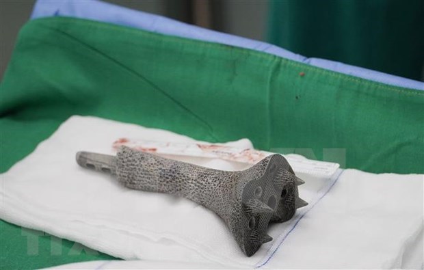 The 3D honeycomb-shaped titanium alloy piece which is successfully transplanted into the leg of a patient suffering from bone cancer from Quang Ngai by HCM City's Cho Ray Hospital. (Photo: VNA)