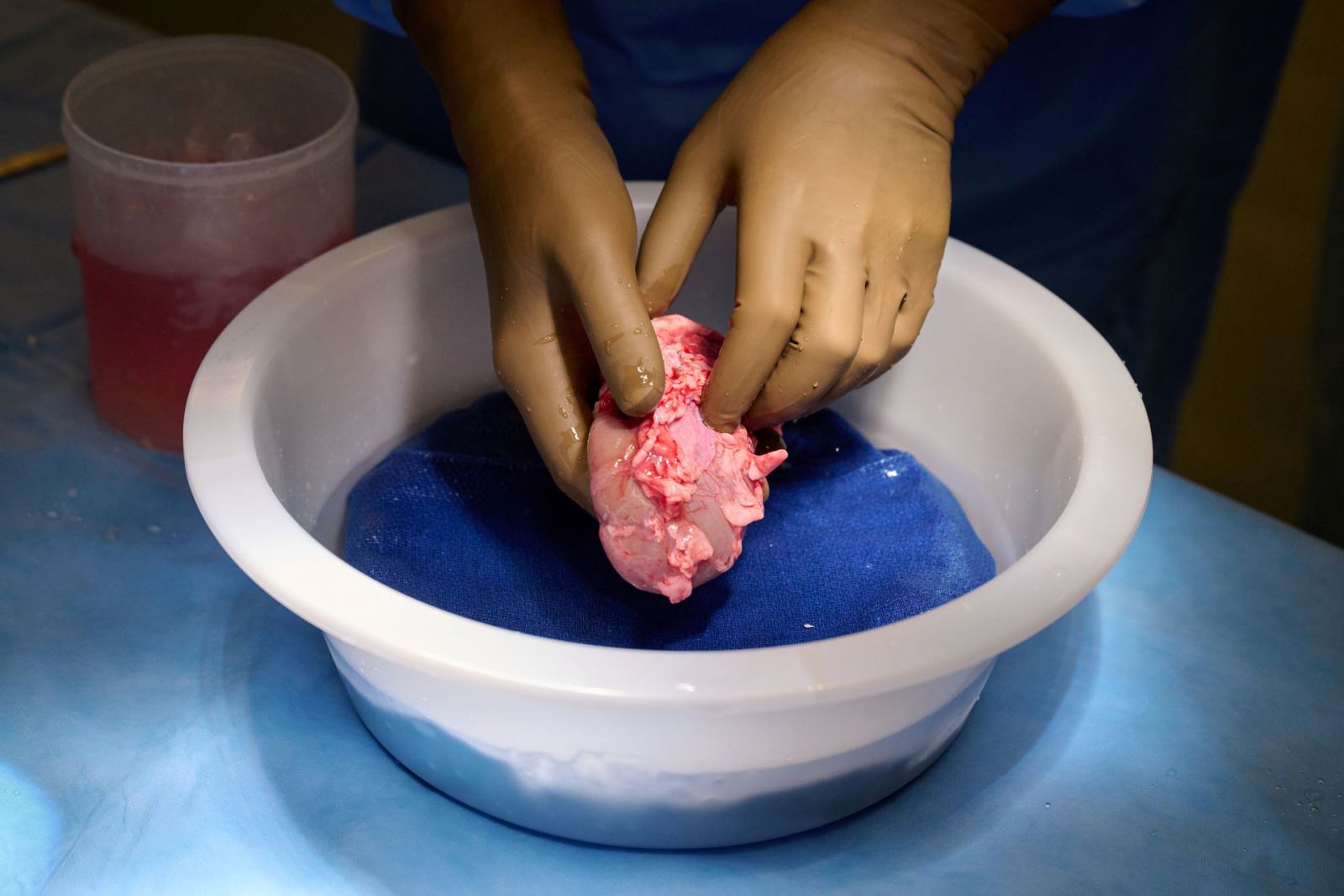 Quả thận lợn được làm sạch, chuẩn bị cho ca cấy ghép với cơ thể người. Ảnh: NYU/Reuters