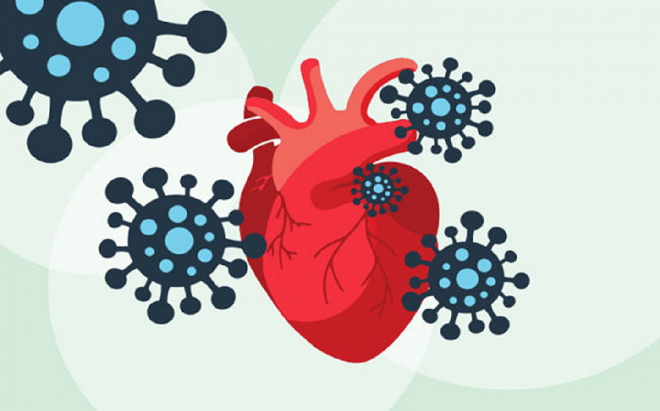 Biến chứng tim mạch hậu COVID-19 có thể xảy ra ở người có bệnh nền tim mạch và cả ở người khỏe mạnh. 