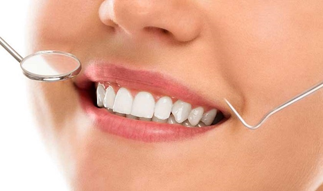 Bọc răng sứ là giải pháp được nhiều người lựa chọn.