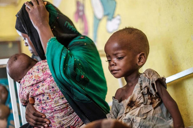 Một đứa trẻ suy dinh dưỡng cùng mẹ có mặt tại Trung tâm Y tế Kelafo ở thị trấn Kelafo, cách thành phố Gode (Ethiopia) 120km ngày 7-4. Ảnh: AP