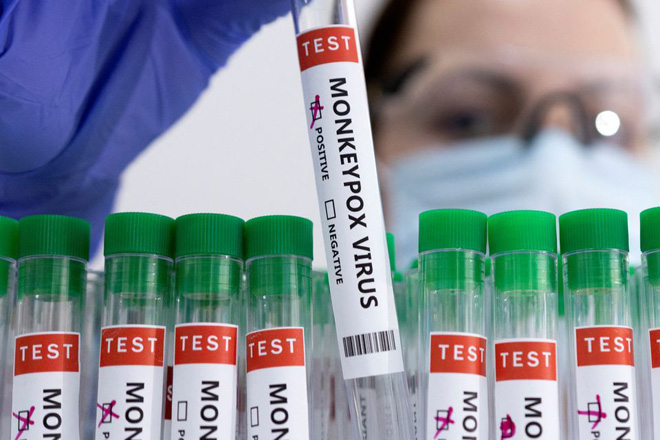 Bệnh đậu mùa khỉ có thể được chẩn đoán bằng xét nghiệm PCR. Ảnh: Reuters