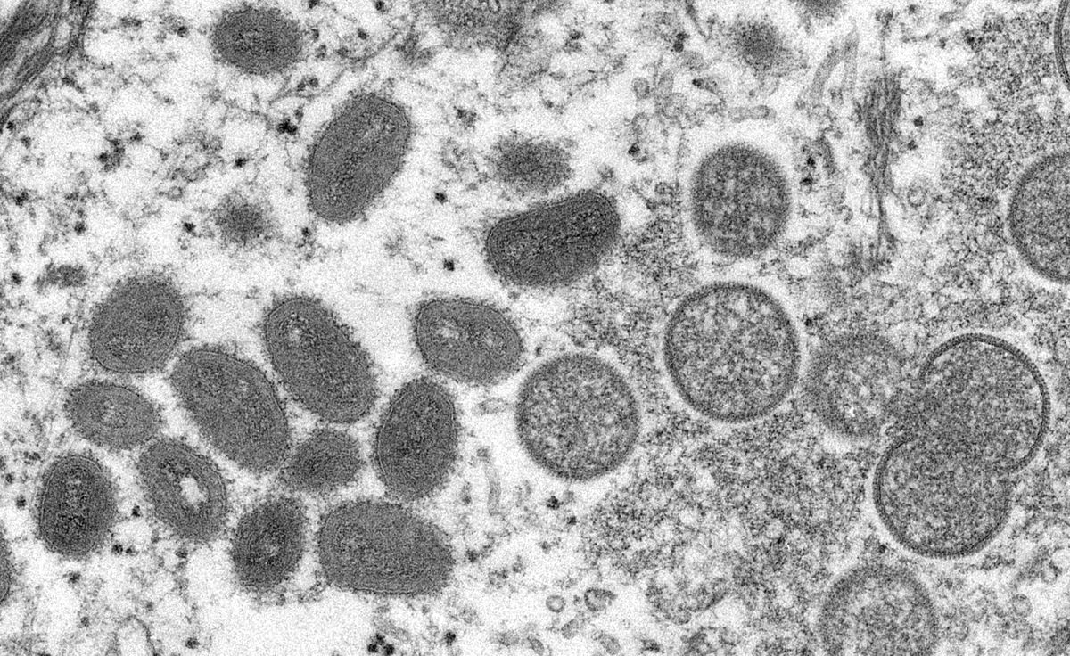 Hình ảnh hiển vi điện tử các hạt virus đậu mùa khỉ (hình bầu dục). Ảnh: Reuters