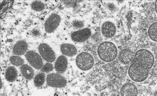 An image of monkeypox virus under an electron microscope.  AFP/VNA Photo