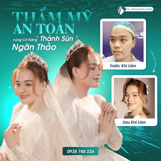 “Thánh sún” Ngân Thảo thực hiện nâng mũi tại BS Phùng Mạnh Cường.