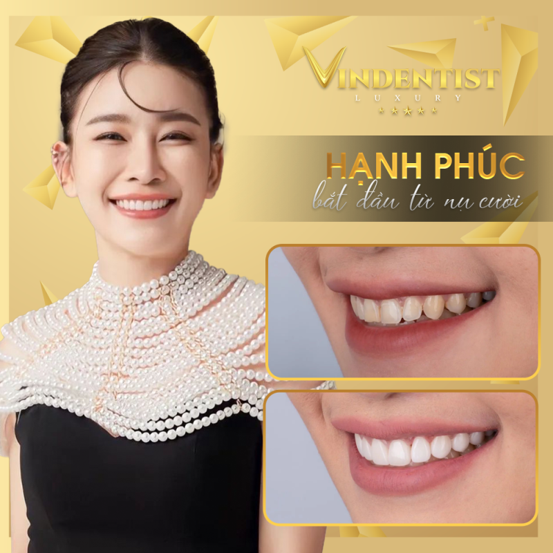 VIN Dentist cung cấp nhiều dịch vụ nha khoa chuyên sâu tại Đà Nẵng.