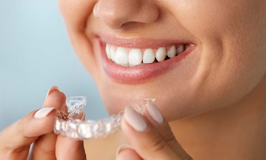 Trải nghiệm niềng răng Invisalign hiệu quả tại Nha khoa Đăng Lưu